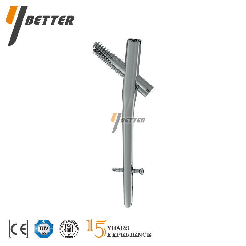 股骨近端可控加壓髓內釘