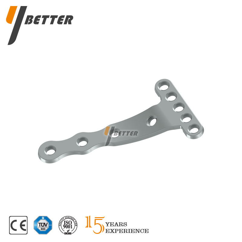 橈骨遠(yuǎn)端掌側(cè)斜T形鎖定板