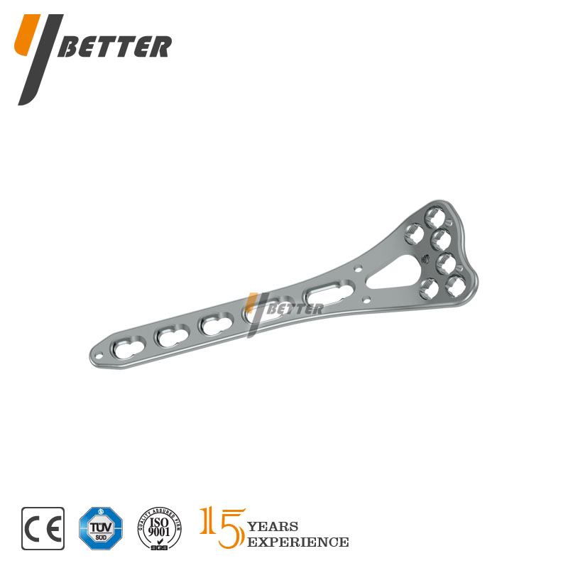 橈骨遠端掌側鎖定板B型