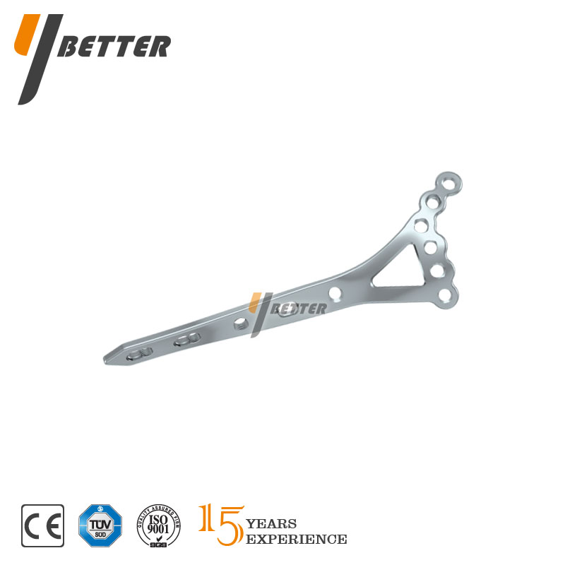 脛骨遠(yuǎn)端前側(cè)鎖定板A型