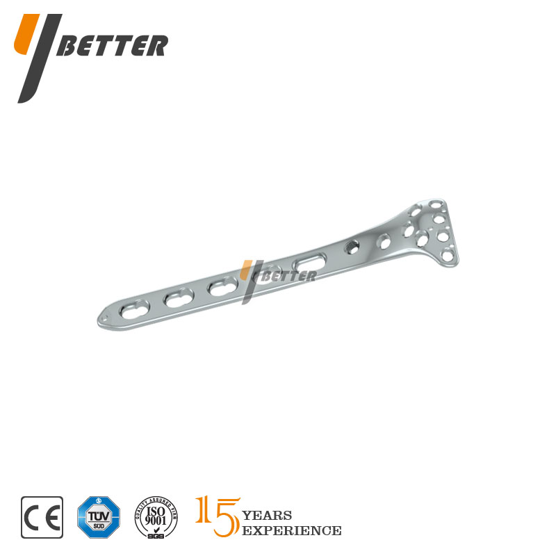 脛骨平臺(tái)外側(cè)鎖定板