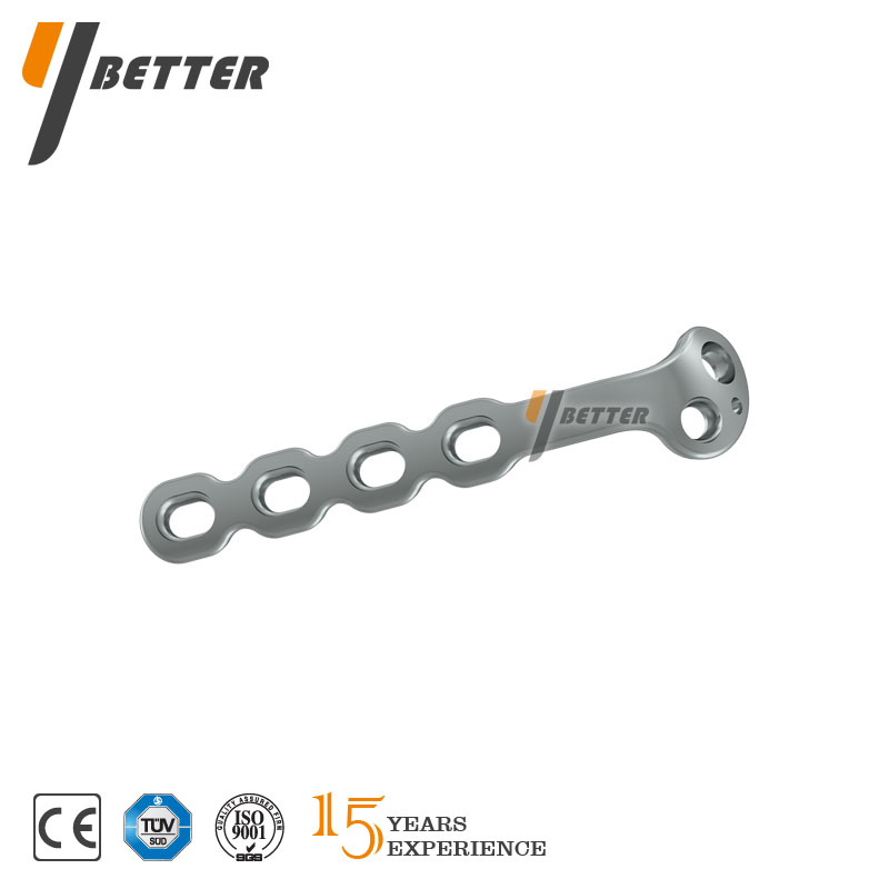 尺骨鷹嘴接骨板