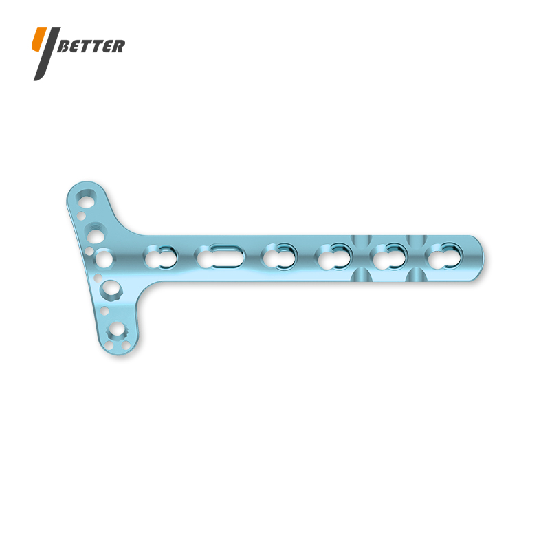 橈骨遠端背側鎖定板（低切跡）