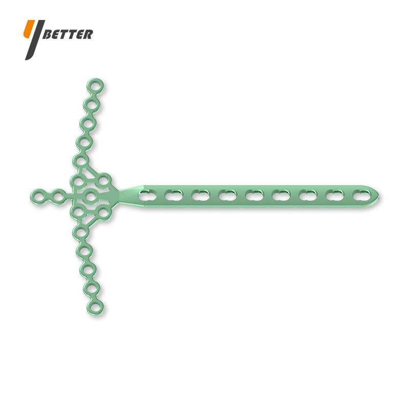 脛骨遠(yuǎn)端海鷗形鎖定板