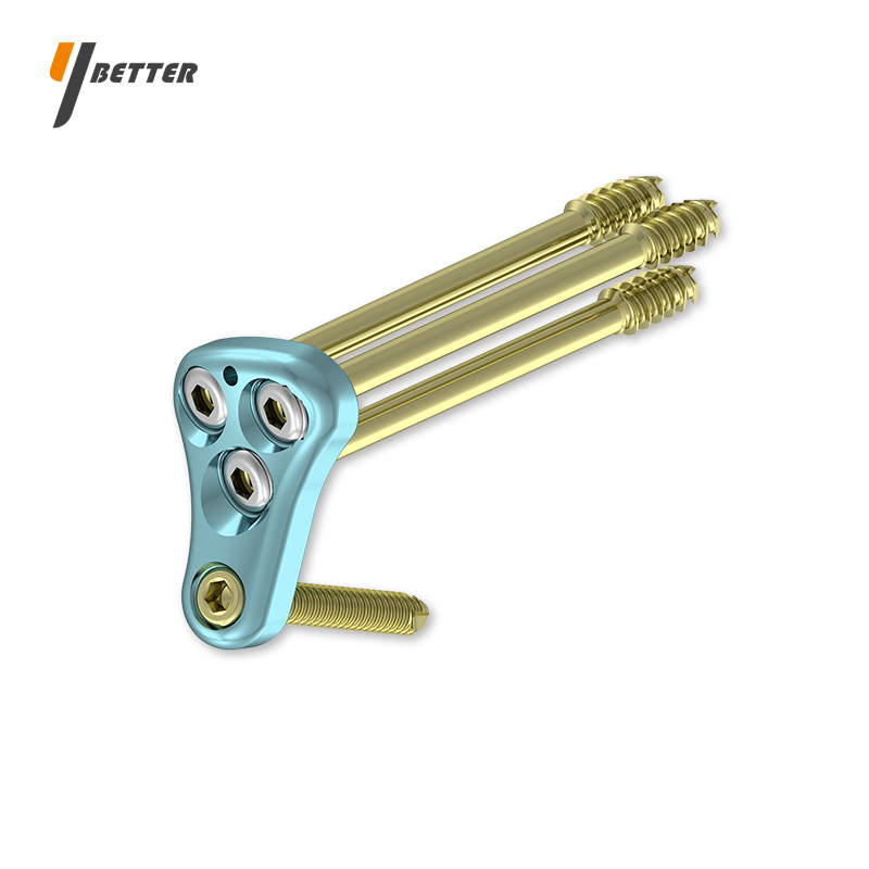 股骨近端鎖定板（萬(wàn)向加壓）