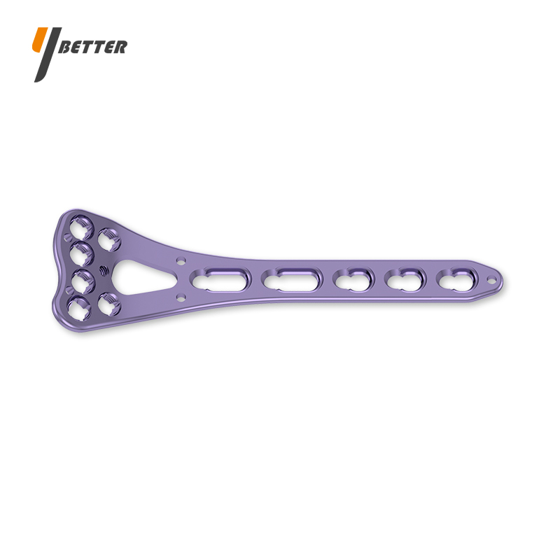 橈骨遠端掌側鎖定板B型