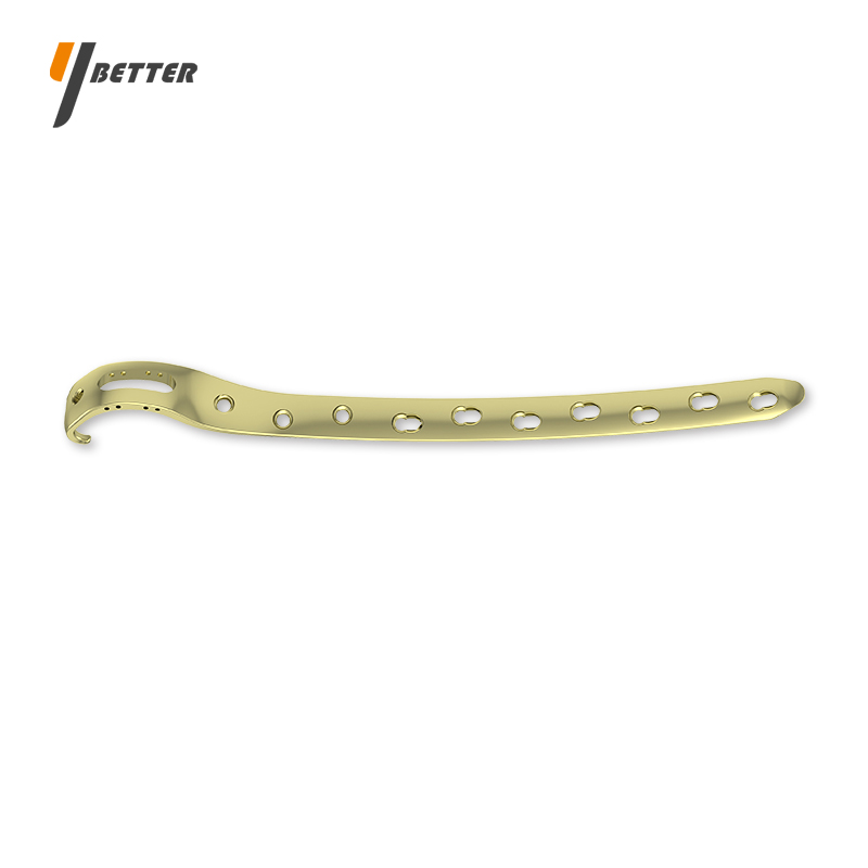 股骨近端翻修鎖定板