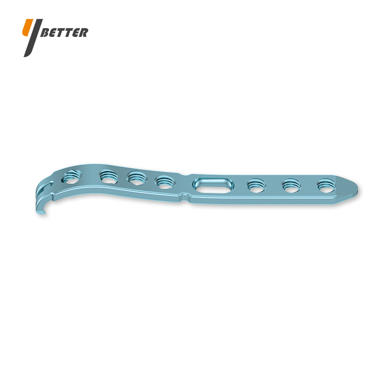 尺骨遠(yuǎn)端鎖定板（尺側(cè)柱）