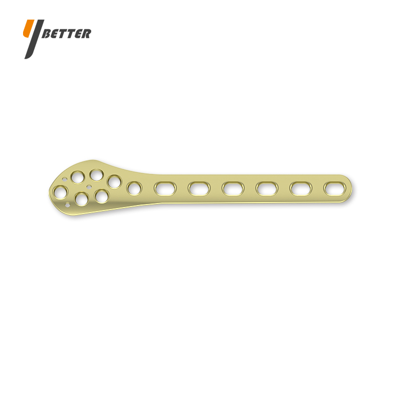 腓骨遠端外側(cè)接骨板I型