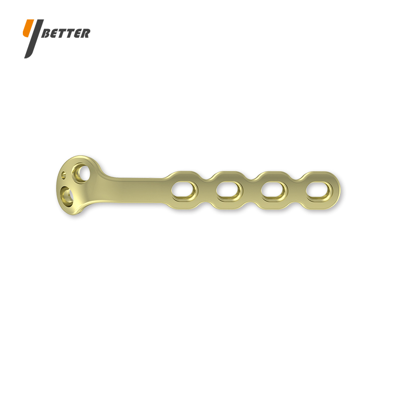 尺骨鷹嘴接骨板