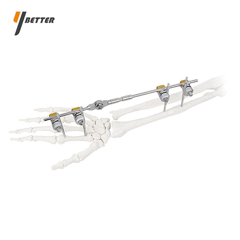 腕關(guān)節(jié)型支架