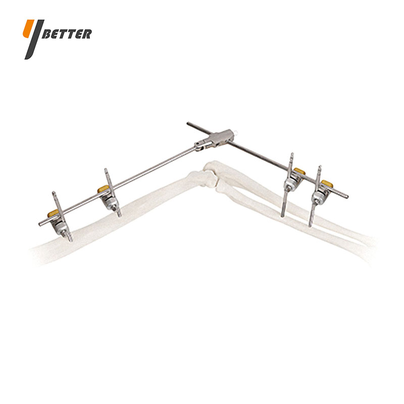 肘關(guān)節(jié)型支架