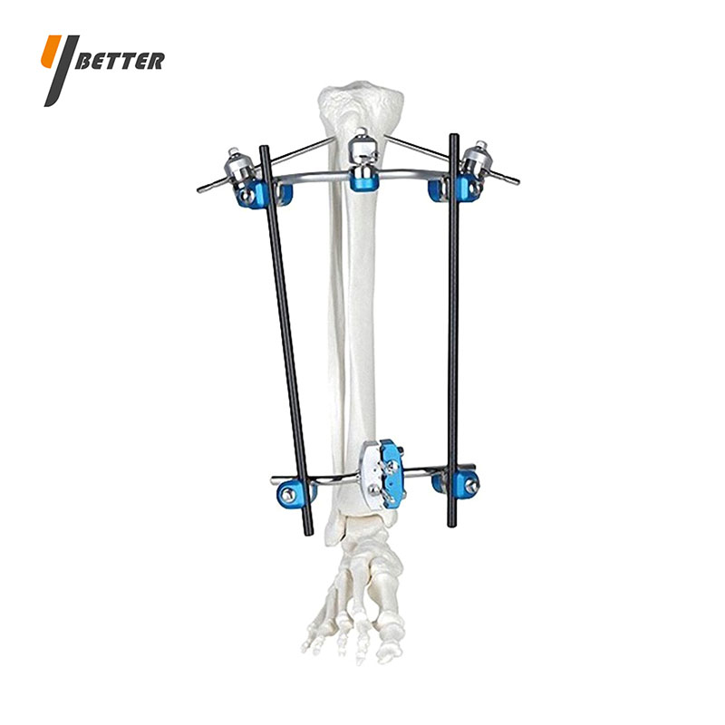 脛骨近端骨折支架