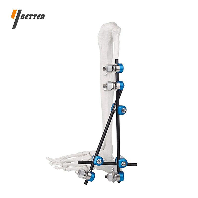 踝關(guān)節(jié)固定