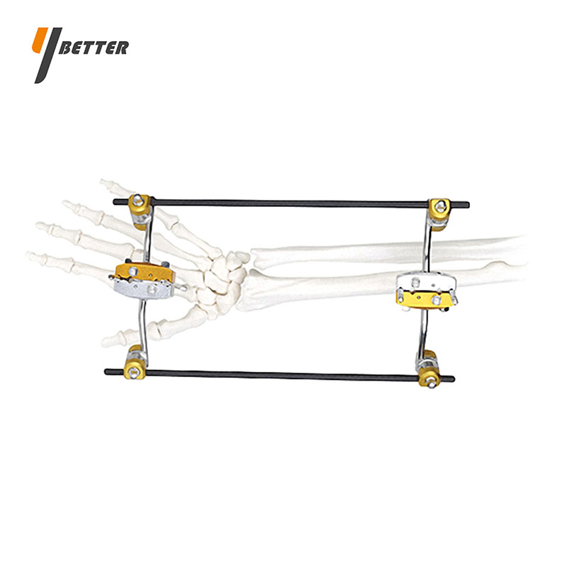 尺橈骨胯關(guān)節(jié)型支架