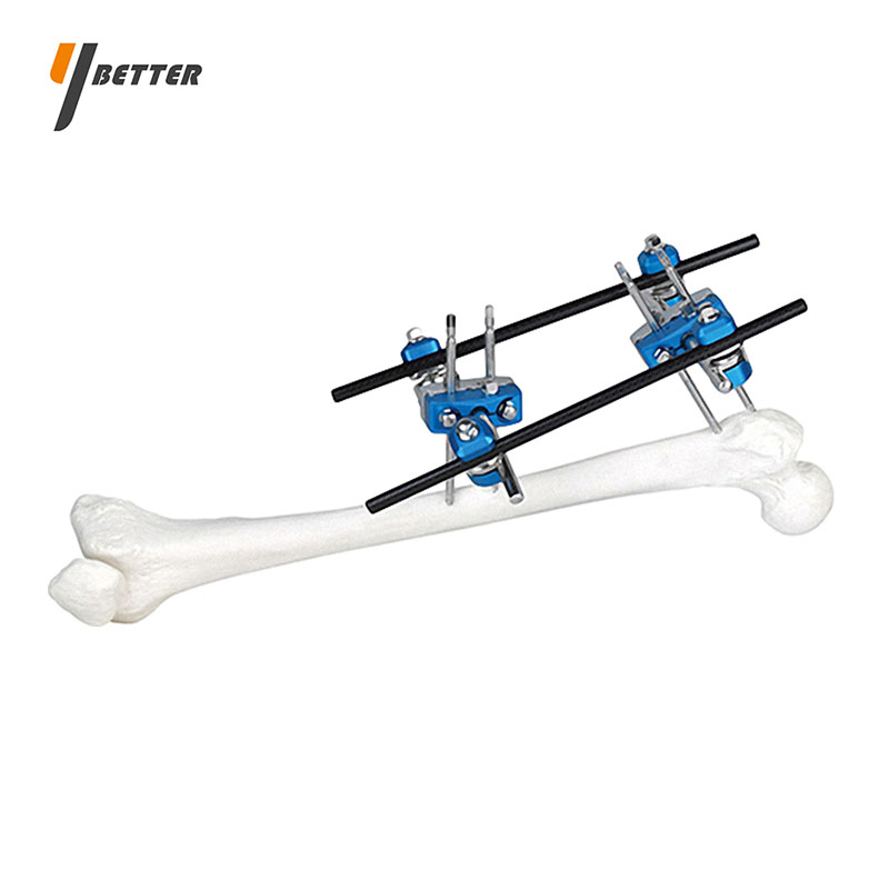 股骨近端骨折支架