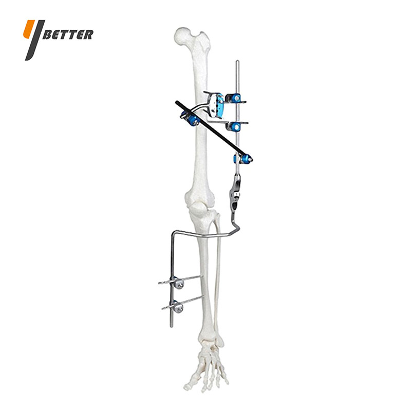 膝關(guān)節(jié)固定