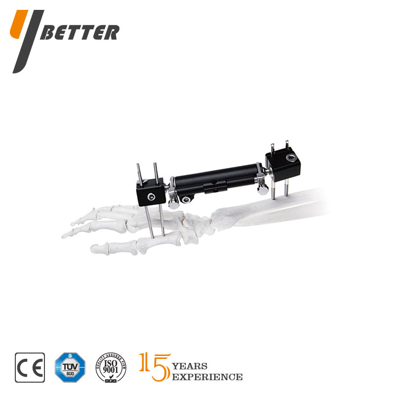 橈骨遠(yuǎn)端可延長支架（PEEK可透光）