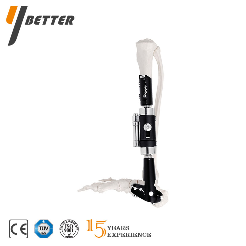 脛骨遠(yuǎn)端骨折支架