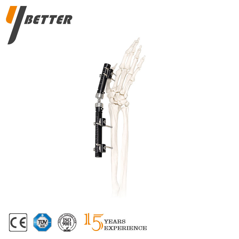 單側(cè)一體式外固定系統(tǒng)