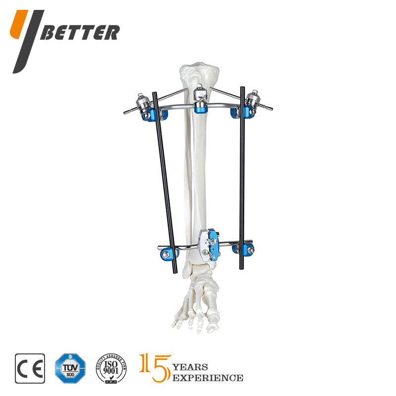 組合式外固定系統(tǒng)