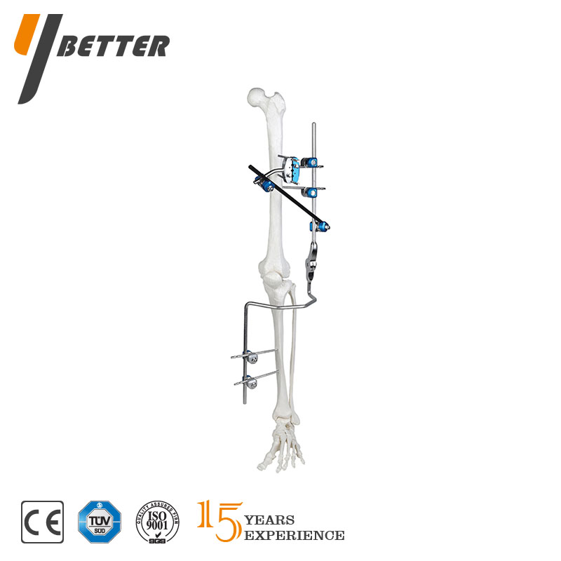 膝關(guān)節(jié)