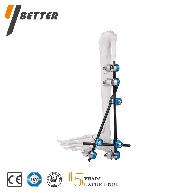 踝關(guān)節(jié)固定