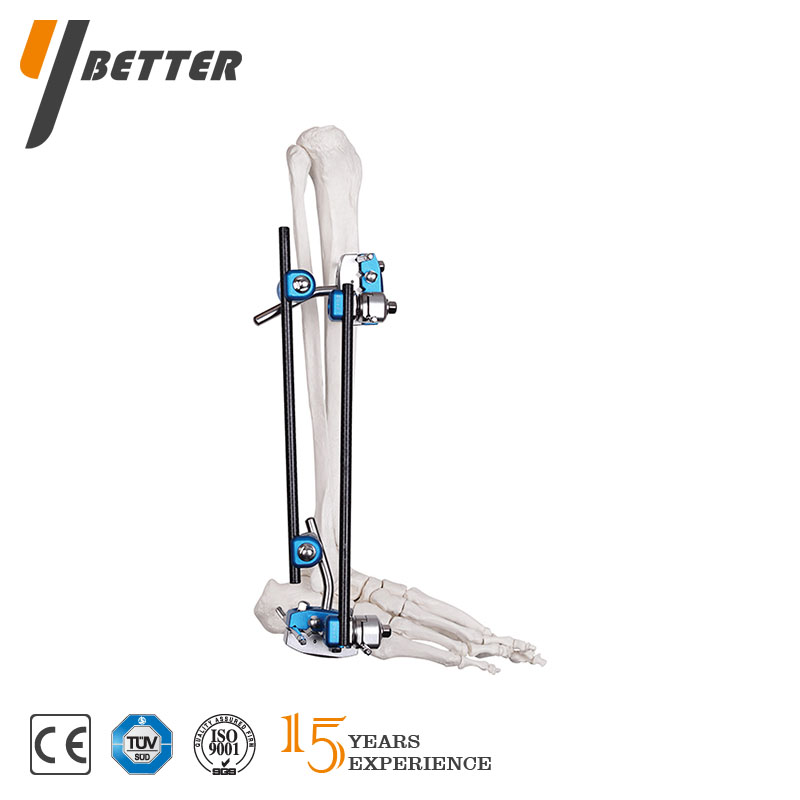 踝關(guān)節(jié)融合